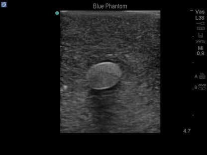 Blue Phantom Femoral kar og nerveerstatningsvæv