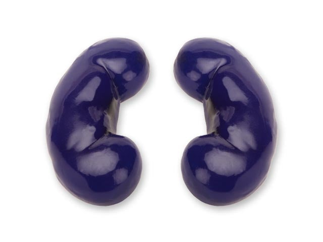 Blue Phantom Replacement kidneys for renal biopsy ultrasound training model