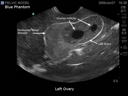 BluePhantom transvaginal ultraljudsträningsmodell för generell patologi