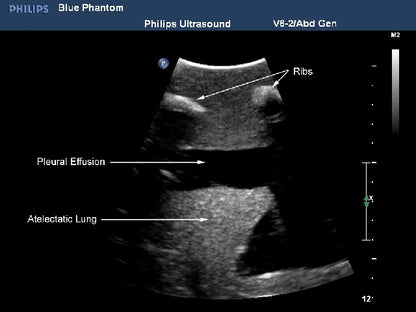 BluePhantom udskiftningsvæv til thoracentese ultralyds-træningsmodel
