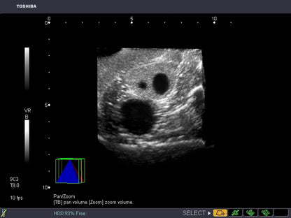 BluePhantom transvaginal ultraljudsträningsmodell för generell patologi