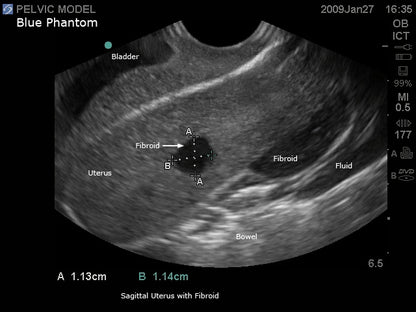 BluePhantom transvaginal ultraljudsträningsmodell för generell patologi