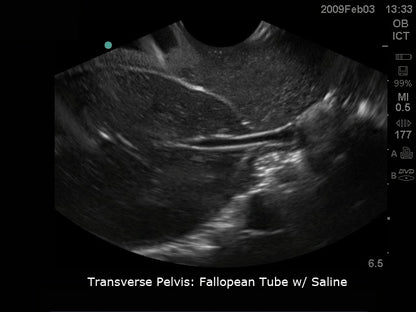 BluePhantom transvaginal ultralydstræningsmodel til sonohysterografi og sonosalpingografi