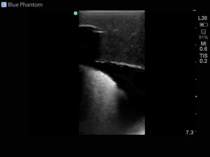 Blue Phantom udskiftningsvæv til midscapulær thoracentese-ultralydsmodel