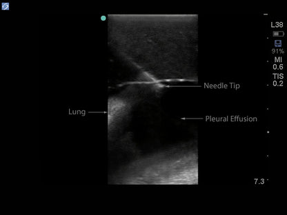 Blue Phantom udskiftningsvæv til midscapulær thoracentese-ultralydsmodel