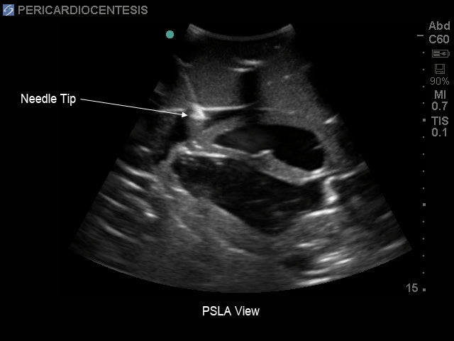 BluePhantom Ultralyds Træningsmodel til Transthorakal Ekkokardiografi og Perikardiocentese