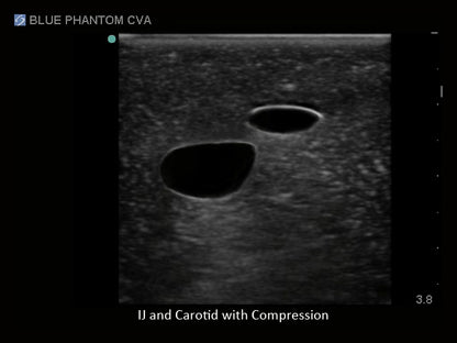 Blue Phantom Ultrasound Central Line Model with Transparent Insert