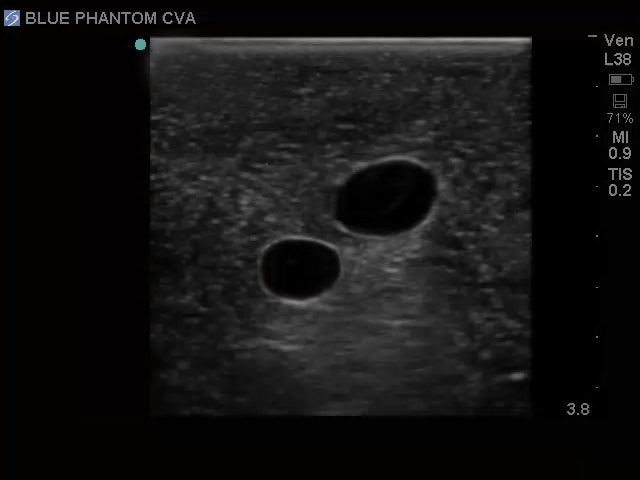 Blue Phantom Ultrasound Central Line Model with Transparent Insert