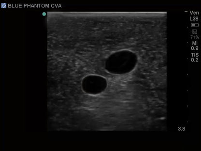 Blue Phantom Ultrasound Central Line Model with Transparent Insert