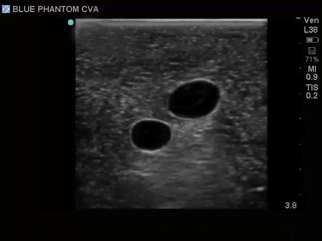 Blue Phantom Ultrasound Training Model Central Line and Regional Anesthesia