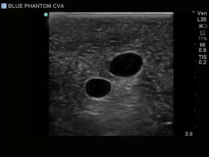 Blue Phantom Ultrasound Training Model Central Line and Regional Anesthesia