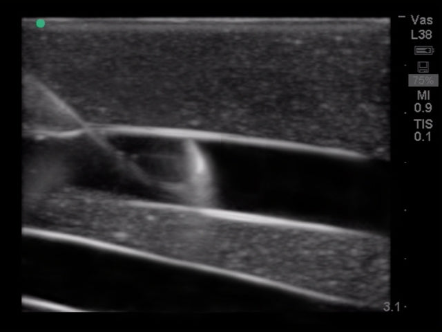 Blue Phantom Ultrasound Training Model Central Line and Regional Anesthesia