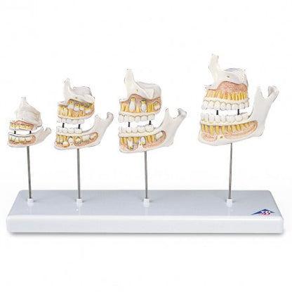 The Development of Dentures
