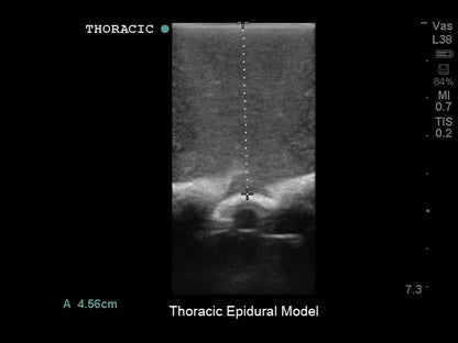 Blue Phantom Lumbar Puncture and Spinal Epidural
