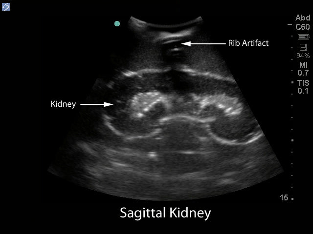Blue Phantom Ultralydstrænings Model Renal Biopsi