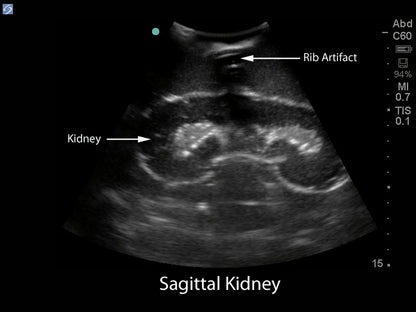 Blue Phantom Ultralydstrænings Model Renal Biopsi