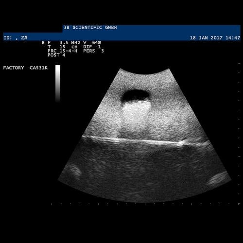 SONOtrain Ultrasound Vein Model