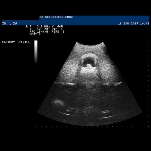 SONOtrain Ultrasound Vein Model