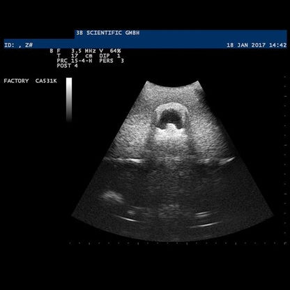 SONOtrain Ultrasound Vein Model