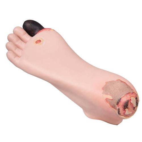 Diabetic Decubitus Trainer Foot