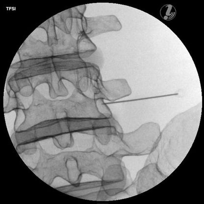 Lumbar Spine Injection Trainer