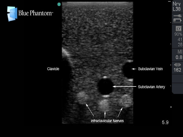 Blue Phantom Ultrasound Training Model Central Line and Regional Anesthesia