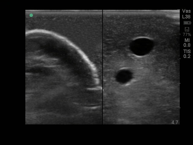 Blue Phantom Ultrasound Training Model Central Line and Regional Anesthesia