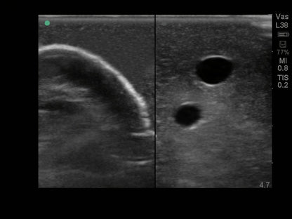 Blue Phantom Ultrasound Training Model Central Line and Regional Anesthesia