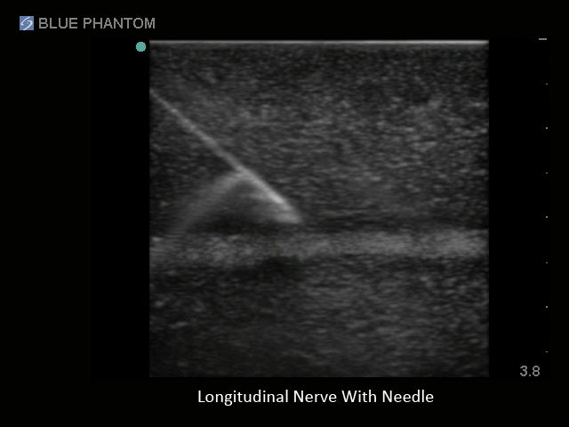Blue Phantom Ultrasound Training Block Regional Anesthesia