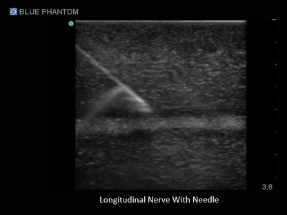 Blue Phantom Ultrasound Training Block Regional Anesthesia