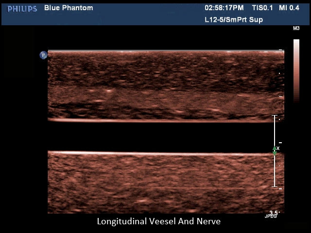 Blue Phantom Ultrasound Training Block Regional Anesthesia