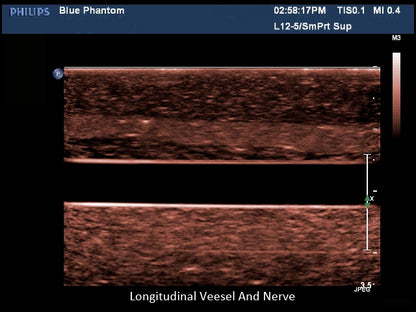 Blue Phantom Ultrasound Training Block Regional Anesthesia