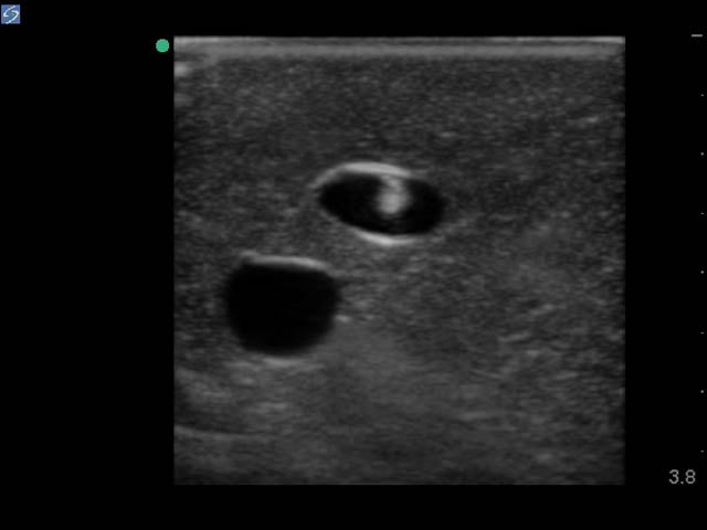 Blue Phantom Ultrasound Training Model Central Line and Regional Anesthesia