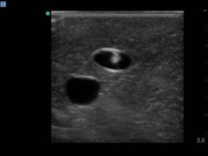 Blue Phantom Ultrasound Training Model Central Line and Regional Anesthesia
