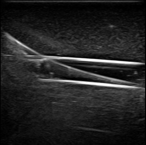 BluePhantom PICC Ultraljudsträningsarm med IV & Arteriell Vaskulär Åtkomst