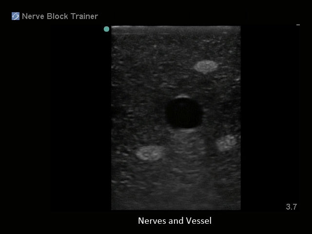 Blue Phantom Ultrasound Training Block Regional Anesthesia