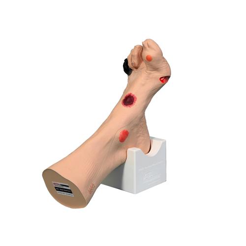 Wound treatment model Foot